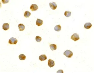 Anti-DFFB antibody used in Immunocytochemistry/ Immunofluorescence (ICC/IF). GTX31261
