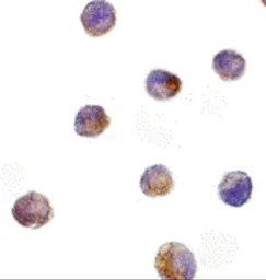 Anti-DFFB antibody used in Immunocytochemistry/ Immunofluorescence (ICC/IF). GTX31263