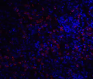Anti-IRAK3 antibody used in Immunocytochemistry/ Immunofluorescence (ICC/IF). GTX31265