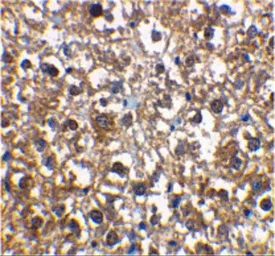 Anti-IRAK3 antibody used in IHC (Paraffin sections) (IHC-P). GTX31265
