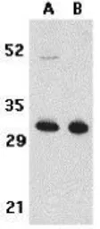 Anti-TACI antibody used in Western Blot (WB). GTX31266