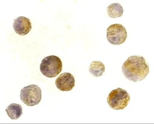 Anti-TACI antibody used in Immunocytochemistry/ Immunofluorescence (ICC/IF). GTX31266