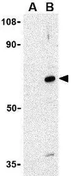 Anti-AVEN antibody used in Western Blot (WB). GTX31269