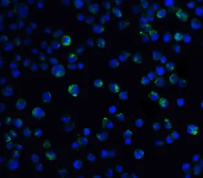 Anti-IL21 Receptor antibody used in Immunocytochemistry/ Immunofluorescence (ICC/IF). GTX31270