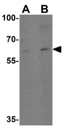 Anti-IL21 Receptor antibody used in Western Blot (WB). GTX31270
