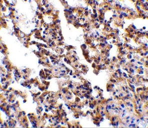 Anti-IL21 Receptor antibody used in IHC (Paraffin sections) (IHC-P). GTX31270