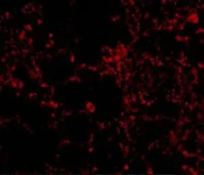 Anti-IL21 Receptor antibody used in IHC (Paraffin sections) (IHC-P). GTX31270
