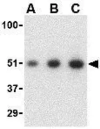Anti-PCBP4 antibody used in Western Blot (WB). GTX31272