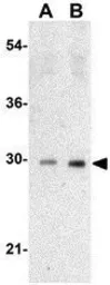 Anti-p53DINP1 antibody used in Western Blot (WB). GTX31278