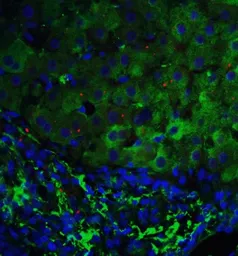 Anti-p53DINP1 antibody used in IHC (Paraffin sections) (IHC-P). GTX31278