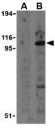 Anti-TLR2 antibody used in Western Blot (WB). GTX31279