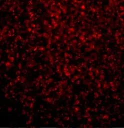 Anti-TLR2 antibody used in IHC (Paraffin sections) (IHC-P). GTX31279