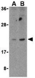 Anti-Bcl-G antibody used in Western Blot (WB). GTX31280