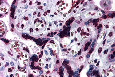 Anti-CARD14 antibody used in IHC (Paraffin sections) (IHC-P). GTX31281