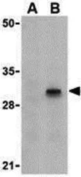 Anti-Caspase 8 antibody used in Western Blot (WB). GTX31285