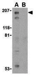 Anti-TSC2 antibody used in Western Blot (WB). GTX31286
