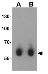 Anti-CRMP1 antibody used in Western Blot (WB). GTX31288