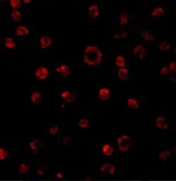 Anti-TLR3 antibody used in Immunocytochemistry/ Immunofluorescence (ICC/IF). GTX31291
