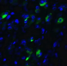 Anti-XBP1 antibody used in IHC (Paraffin sections) (IHC-P). GTX31293