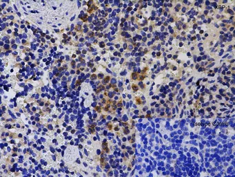 Anti-XBP1 antibody used in IHC (Paraffin sections) (IHC-P). GTX31293