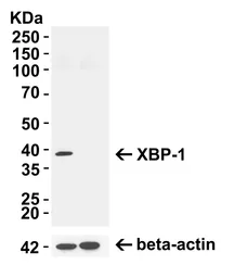 Anti-XBP1 antibody used in Western Blot (WB). GTX31293
