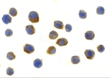 Anti-TLR9 antibody used in Immunocytochemistry/ Immunofluorescence (ICC/IF). GTX31295