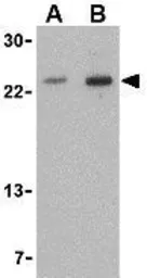 Anti-TNFRSF14 antibody used in Western Blot (WB). GTX31297