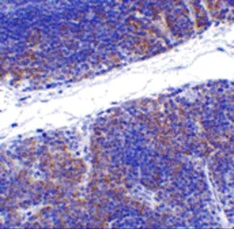 Anti-TNFRSF14 antibody used in IHC (Paraffin sections) (IHC-P). GTX31297
