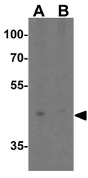 Anti-TIM-4 antibody used in Western Blot (WB). GTX31299