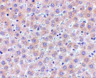 Anti-sRANKL antibody used in IHC (Paraffin sections) (IHC-P). GTX31300