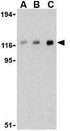Anti-CBL antibody used in Western Blot (WB). GTX31301