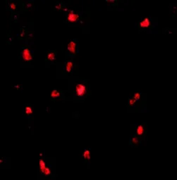 Anti-CBL antibody used in IHC (Paraffin sections) (IHC-P). GTX31301