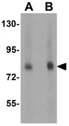 Anti-FAF1 antibody used in Western Blot (WB). GTX31302