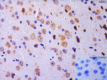 Anti-MDA5 antibody used in IHC (Paraffin sections) (IHC-P). GTX31304