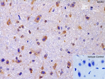 Anti-MDA5 antibody used in IHC (Paraffin sections) (IHC-P). GTX31304
