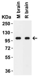 Anti-MDA5 antibody used in Western Blot (WB). GTX31304