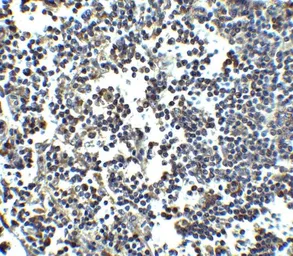 Anti-MDA5 antibody used in IHC (Paraffin sections) (IHC-P). GTX31304