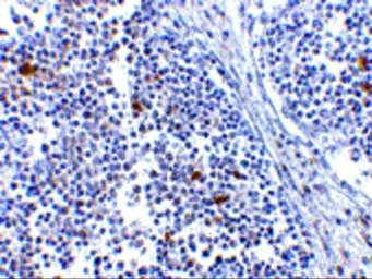Anti-MDA5 antibody used in IHC (Paraffin sections) (IHC-P). GTX31305