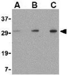 Anti-TIGAR antibody used in Western Blot (WB). GTX31306