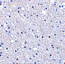 Anti-TIGAR antibody used in IHC (Paraffin sections) (IHC-P). GTX31306