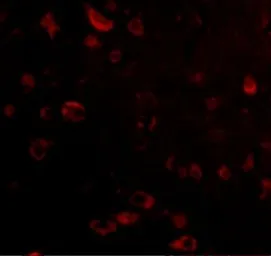 Anti-TIGAR antibody used in IHC (Paraffin sections) (IHC-P). GTX31307