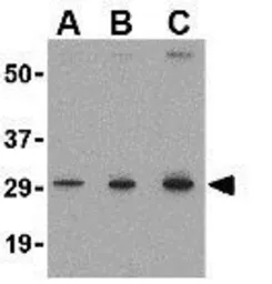 Anti-TIGAR antibody used in Western Blot (WB). GTX31307