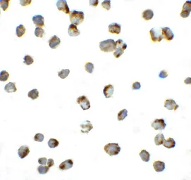 Anti-PD1 antibody used in Immunocytochemistry/ Immunofluorescence (ICC/IF). GTX31309