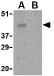 Anti-PD1 antibody used in Western Blot (WB). GTX31309