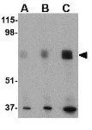 Anti-SIN1 antibody used in Western Blot (WB). GTX31311