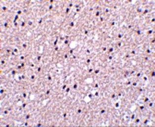 Anti-Presenilin 1 antibody used in IHC (Paraffin sections) (IHC-P). GTX31313