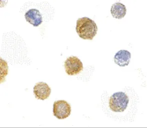 Anti-FYB antibody used in Immunocytochemistry/ Immunofluorescence (ICC/IF). GTX31318