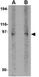 Anti-DISC1 antibody used in Western Blot (WB). GTX31319