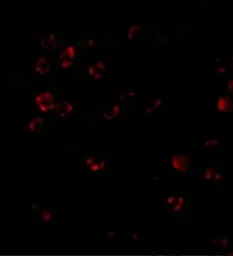 Anti-DISC1 antibody used in Immunocytochemistry/ Immunofluorescence (ICC/IF). GTX31320