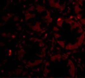 Anti-CCK4 antibody used in IHC (Paraffin sections) (IHC-P). GTX31321